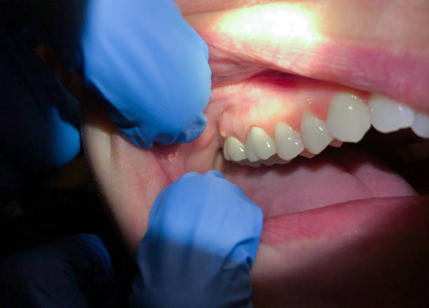 Best Tooth Pain Emergency Relief  in Myrtle Grove, NC